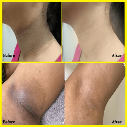 ClearTan™ – Dead Skin & Tan Remover for Smooth, Radiant Skin